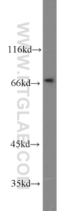 HSF1 Antibody in Western Blot (WB)