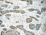 PBK Antibody in Immunohistochemistry (Paraffin) (IHC (P))