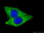 LPCAT1 Antibody in Immunocytochemistry (ICC/IF)