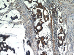 LPCAT1 Antibody in Immunohistochemistry (Paraffin) (IHC (P))