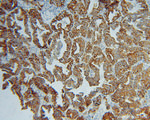 LPCAT1 Antibody in Immunohistochemistry (Paraffin) (IHC (P))