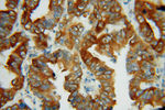 LPCAT1 Antibody in Immunohistochemistry (Paraffin) (IHC (P))