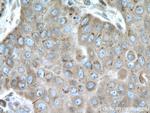 LPCAT1 Antibody in Immunohistochemistry (Paraffin) (IHC (P))