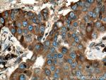 LPCAT1 Antibody in Immunohistochemistry (Paraffin) (IHC (P))