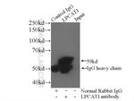 LPCAT1 Antibody in Immunoprecipitation (IP)