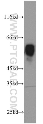 LPCAT1 Antibody in Western Blot (WB)