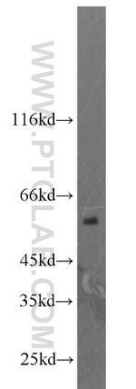 LPCAT1 Antibody in Western Blot (WB)