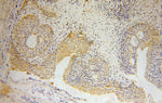 MTHFD1L Antibody in Immunohistochemistry (Paraffin) (IHC (P))