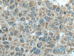 MTHFD1L Antibody in Immunohistochemistry (Paraffin) (IHC (P))