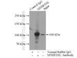 MTHFD1L Antibody in Immunoprecipitation (IP)