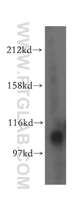 MTHFD1L Antibody in Western Blot (WB)