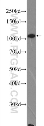 MTHFD1L Antibody in Western Blot (WB)