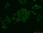 TAF11 Antibody in Immunocytochemistry (ICC/IF)