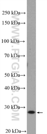 TAF11 Antibody in Western Blot (WB)