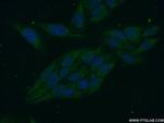 PPP1R8 Antibody in Immunocytochemistry (ICC/IF)