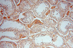 PPP1R8 Antibody in Immunohistochemistry (Paraffin) (IHC (P))