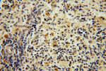 PPP1R8 Antibody in Immunohistochemistry (Paraffin) (IHC (P))