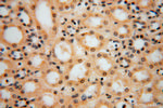 PPP1R8 Antibody in Immunohistochemistry (Paraffin) (IHC (P))