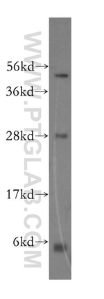 PPP1R8 Antibody in Western Blot (WB)