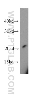 RAC1/2/3 Antibody in Western Blot (WB)