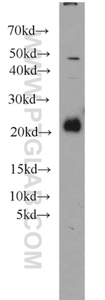 RAC1/2/3 Antibody in Western Blot (WB)