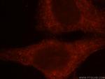 RAC1/2/3 Antibody in Immunocytochemistry (ICC/IF)