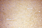 RAC1/2/3 Antibody in Immunohistochemistry (Paraffin) (IHC (P))