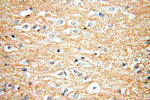 RAC1/2/3 Antibody in Immunohistochemistry (Paraffin) (IHC (P))