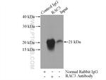 RAC1/2/3 Antibody in Immunoprecipitation (IP)