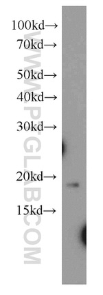 NAT13 Antibody in Western Blot (WB)