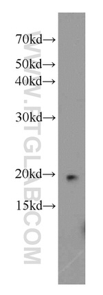 NAT13 Antibody in Western Blot (WB)