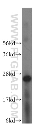 ARHGDIB Antibody in Western Blot (WB)