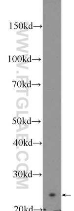 ARHGDIB Antibody in Western Blot (WB)