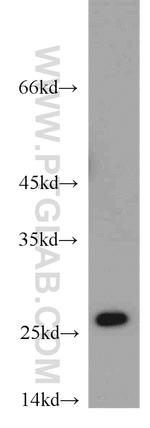 ARHGDIB Antibody in Western Blot (WB)