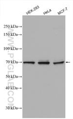 TARA Antibody in Western Blot (WB)