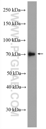 TARA Antibody in Western Blot (WB)