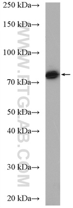 TARA Antibody in Western Blot (WB)