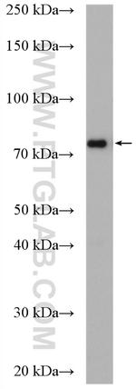 TARA Antibody in Western Blot (WB)