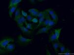 PGAM1 Antibody in Immunocytochemistry (ICC/IF)