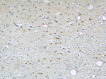 PGAM1 Antibody in Immunohistochemistry (Paraffin) (IHC (P))