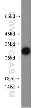 PGAM1 Antibody in Western Blot (WB)