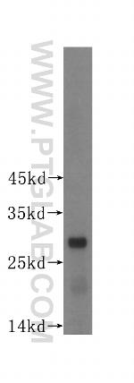 PGAM1 Antibody in Western Blot (WB)