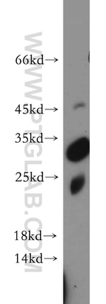 PGAM1 Antibody in Western Blot (WB)