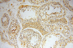 NXN Antibody in Immunohistochemistry (Paraffin) (IHC (P))