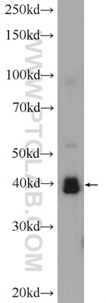 Citrate synthase Antibody in Western Blot (WB)