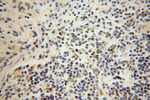 RNASEH2A Antibody in Immunohistochemistry (Paraffin) (IHC (P))