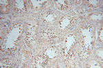 RNASEH2A Antibody in Immunohistochemistry (Paraffin) (IHC (P))