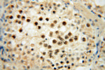 RNASEH2A Antibody in Immunohistochemistry (Paraffin) (IHC (P))