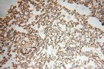 MUL1 Antibody in Immunohistochemistry (Paraffin) (IHC (P))