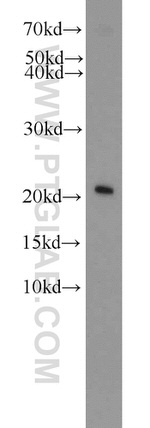 ITPA Antibody in Western Blot (WB)